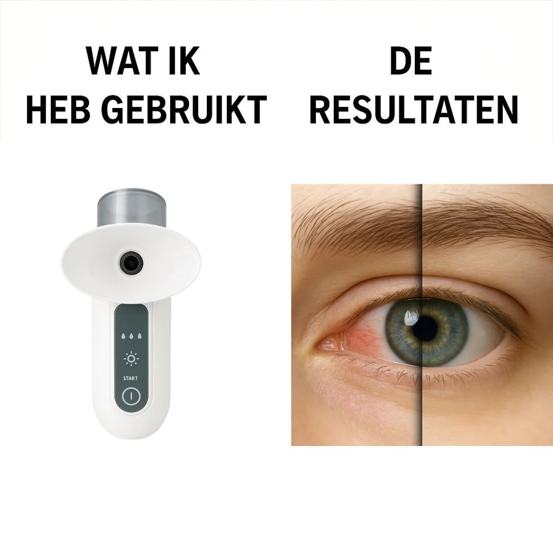 Augenspray – Beruhigt und erfrischt müde Augen 