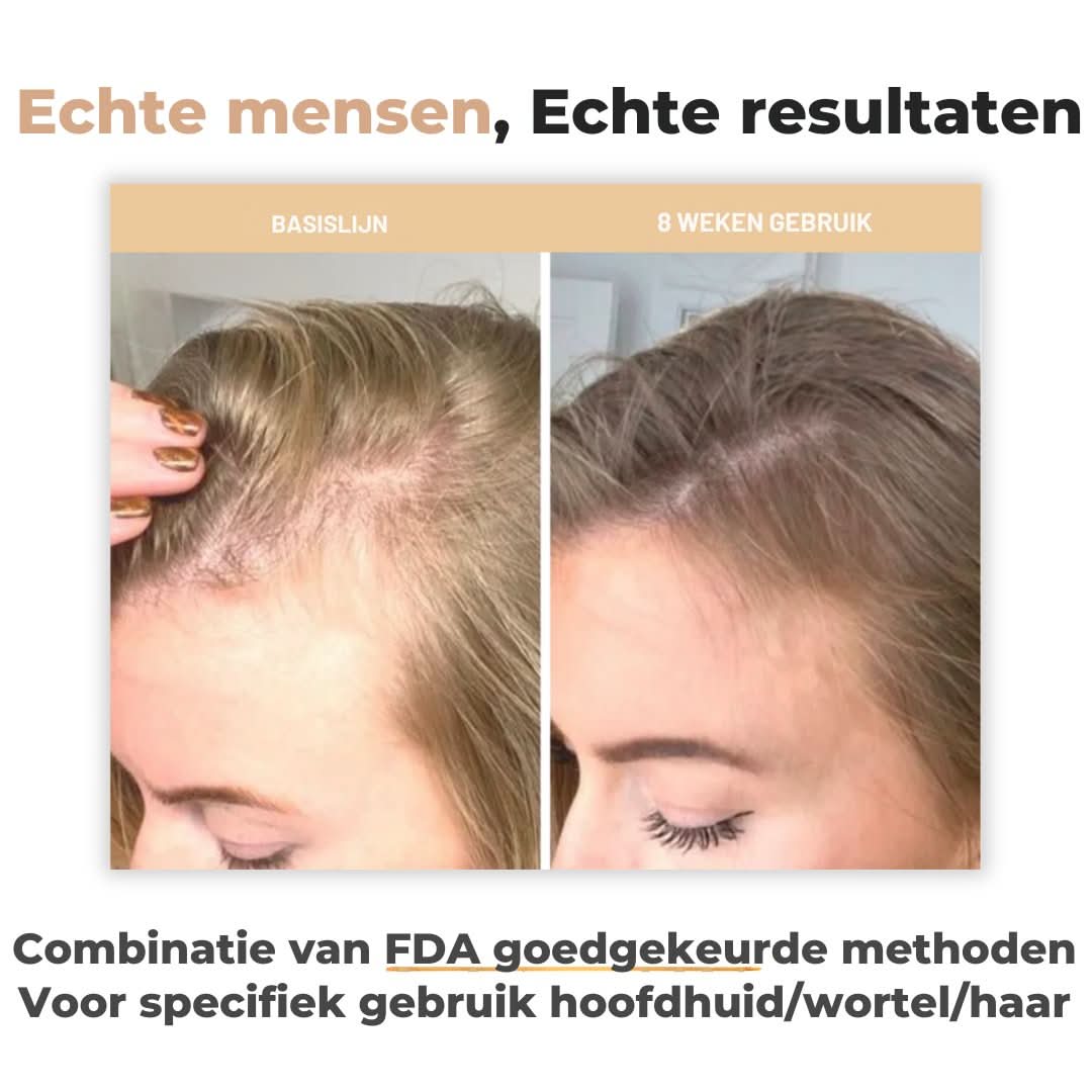 Haar Herstel™ - #Haar Herstel™De Bazelaar